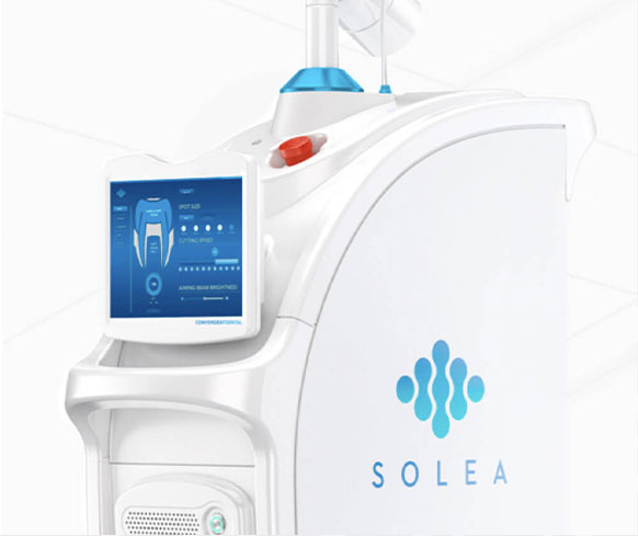 solea laser machine at smith dentalworks
