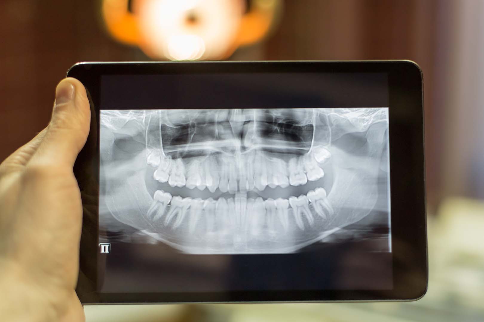dental x ray displayed on the tablet screen