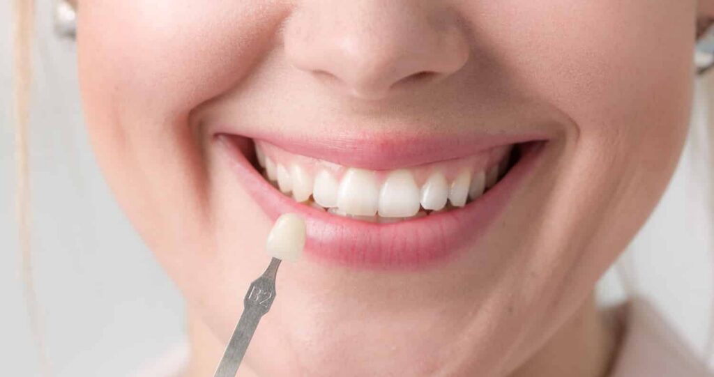 A woman smiling while having porcelain veneers matched to her tooth color