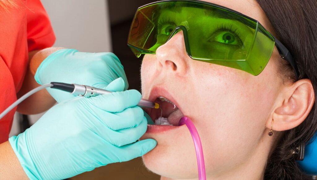 a smith dentalworks dentist using laser dentistry for cavitaies