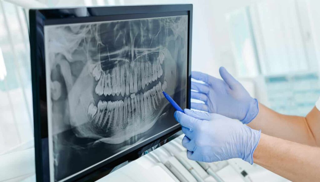 Dental professional analyzing dental X-ray on a monitor, highlighting the importance of advanced diagnostic technology in modern dentistry.