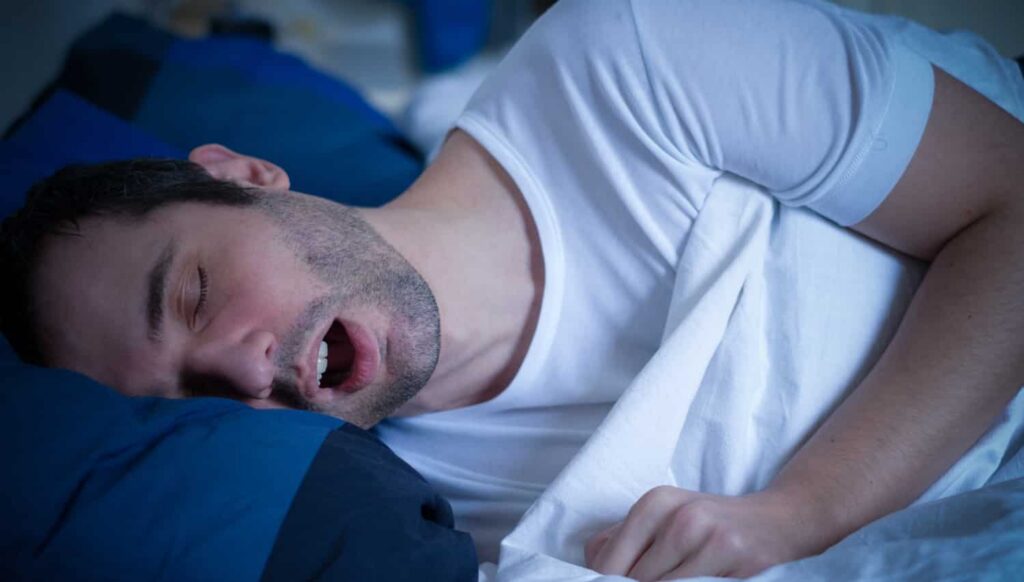Man sleeping with open mouth on blue and white pillows, illustrating symptoms of sleep apnea related to bruxism.