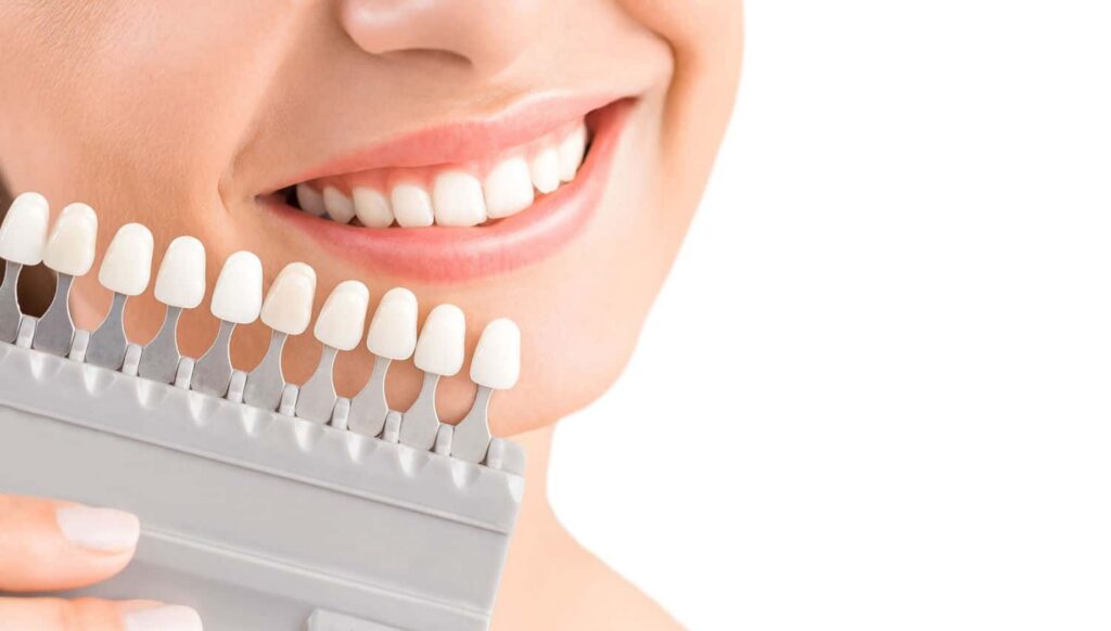 Smiling woman holding a teeth shade guide, showcasing various tooth whiteness levels for effective teeth whitening treatment.