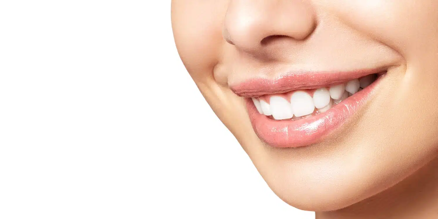 a girl with a bright hollywood smile after getting cosmetic dentistry at smith dentalworks