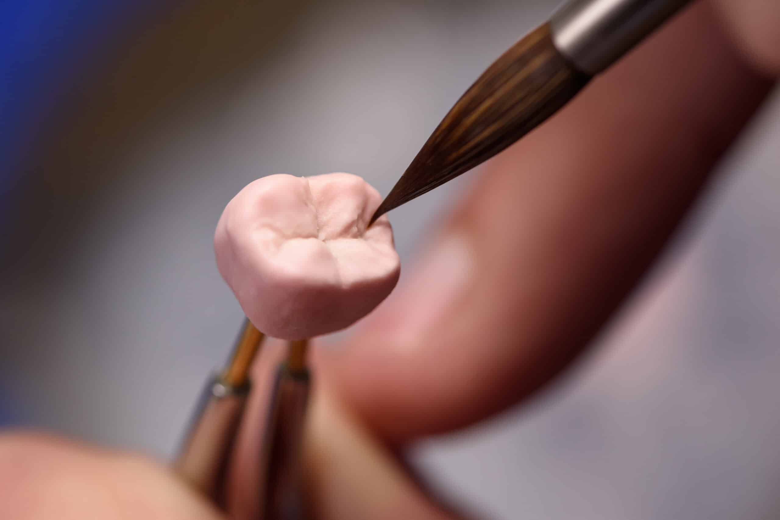 Dental technician sculpting a dental crown from pink material, showcasing precision in cosmetic dentistry.