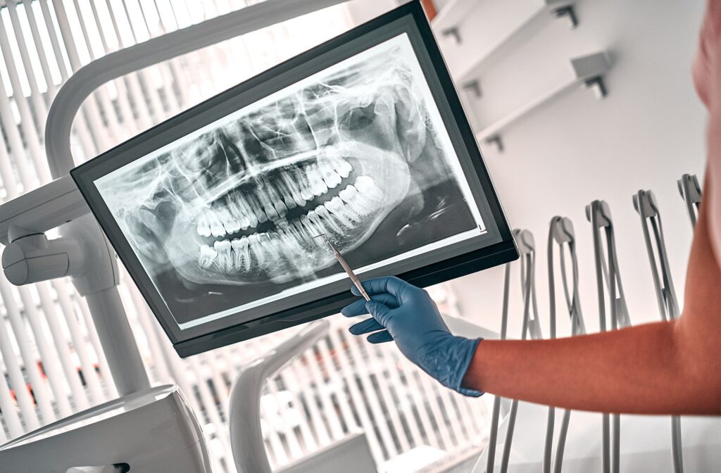 Dental professional examining X-ray of patient's teeth, highlighting the importance of oral health in relation to chronic diseases at Smith Dentalworks.