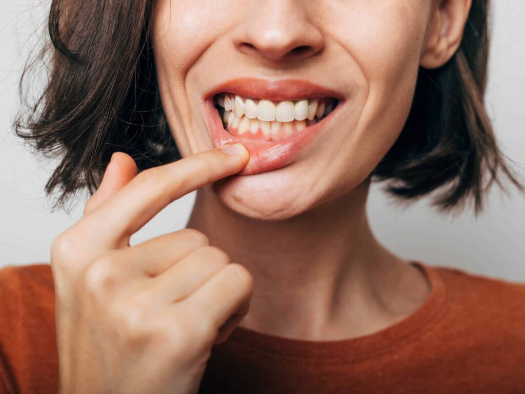Woman examining her gums for bleeding, highlighting oral health concerns related to gum disease and hygiene.