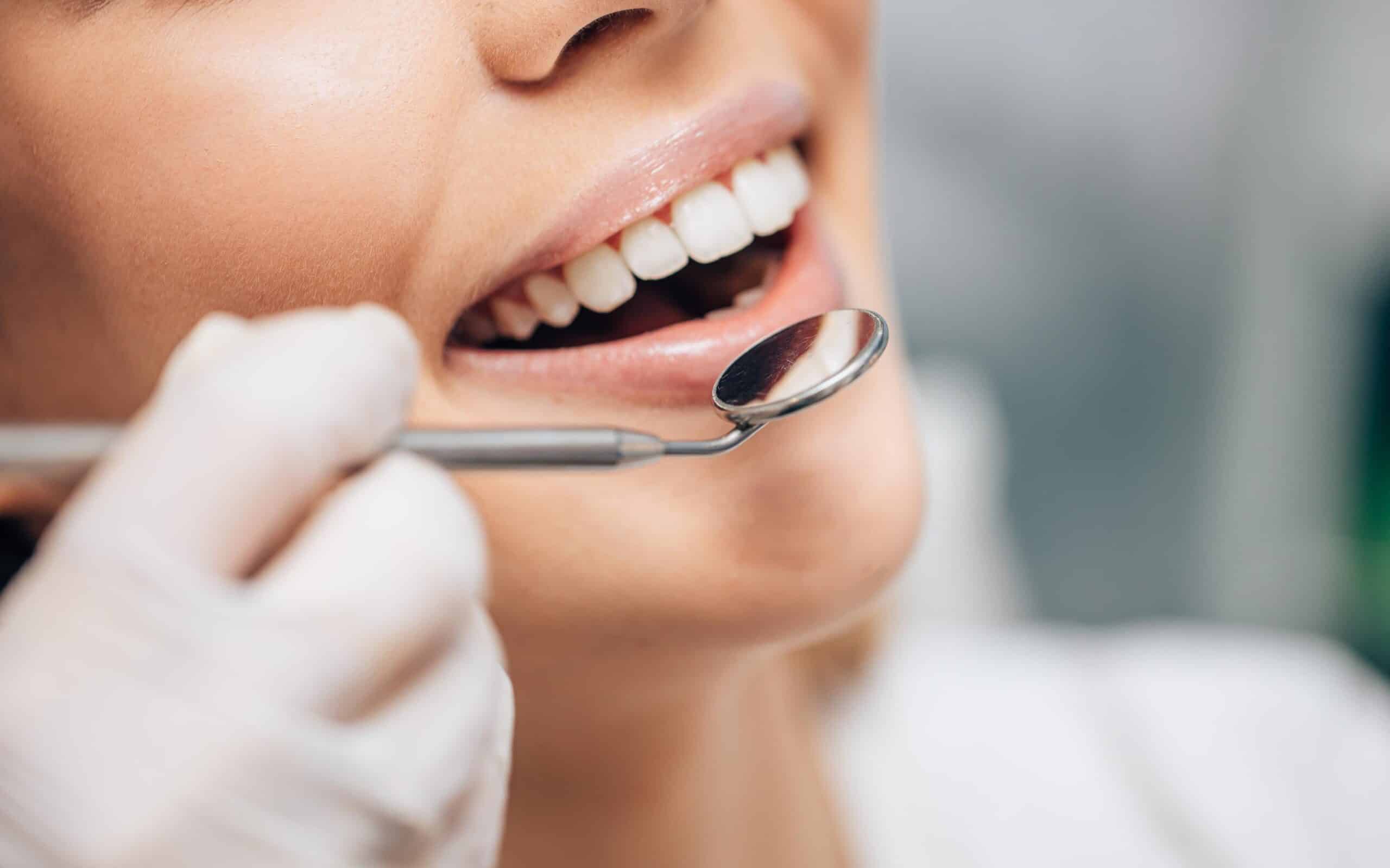 Close-up of a patient smiling with healthy teeth, while a dentist examines their mouth using a dental mirror, highlighting oral health and dental care.