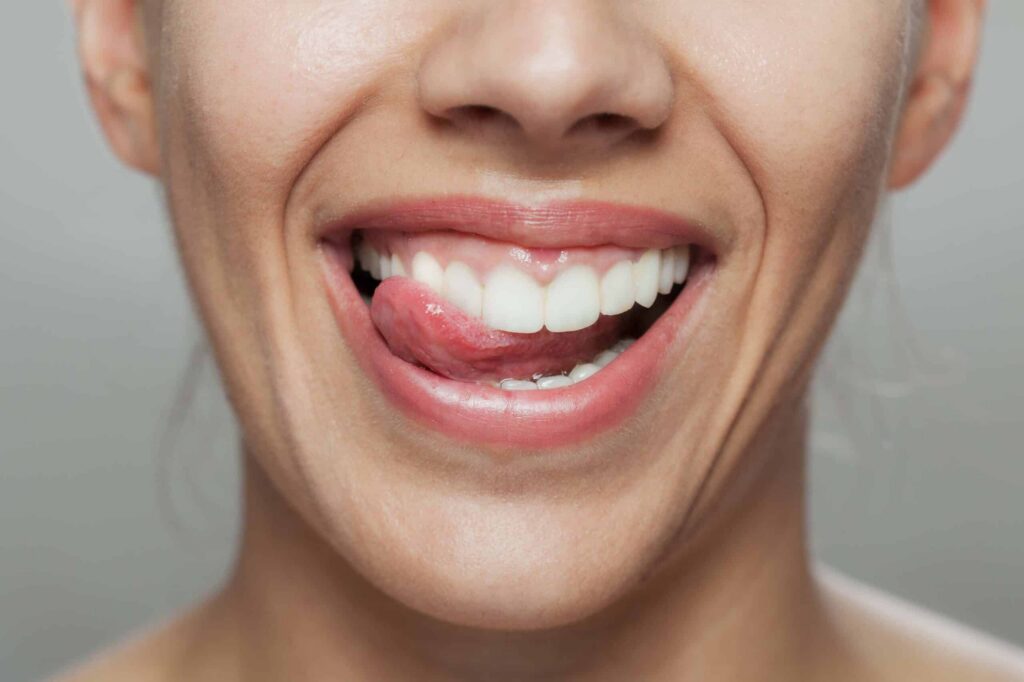 Smiling woman with tongue out, highlighting oral health and tongue appearance related to dental issues.