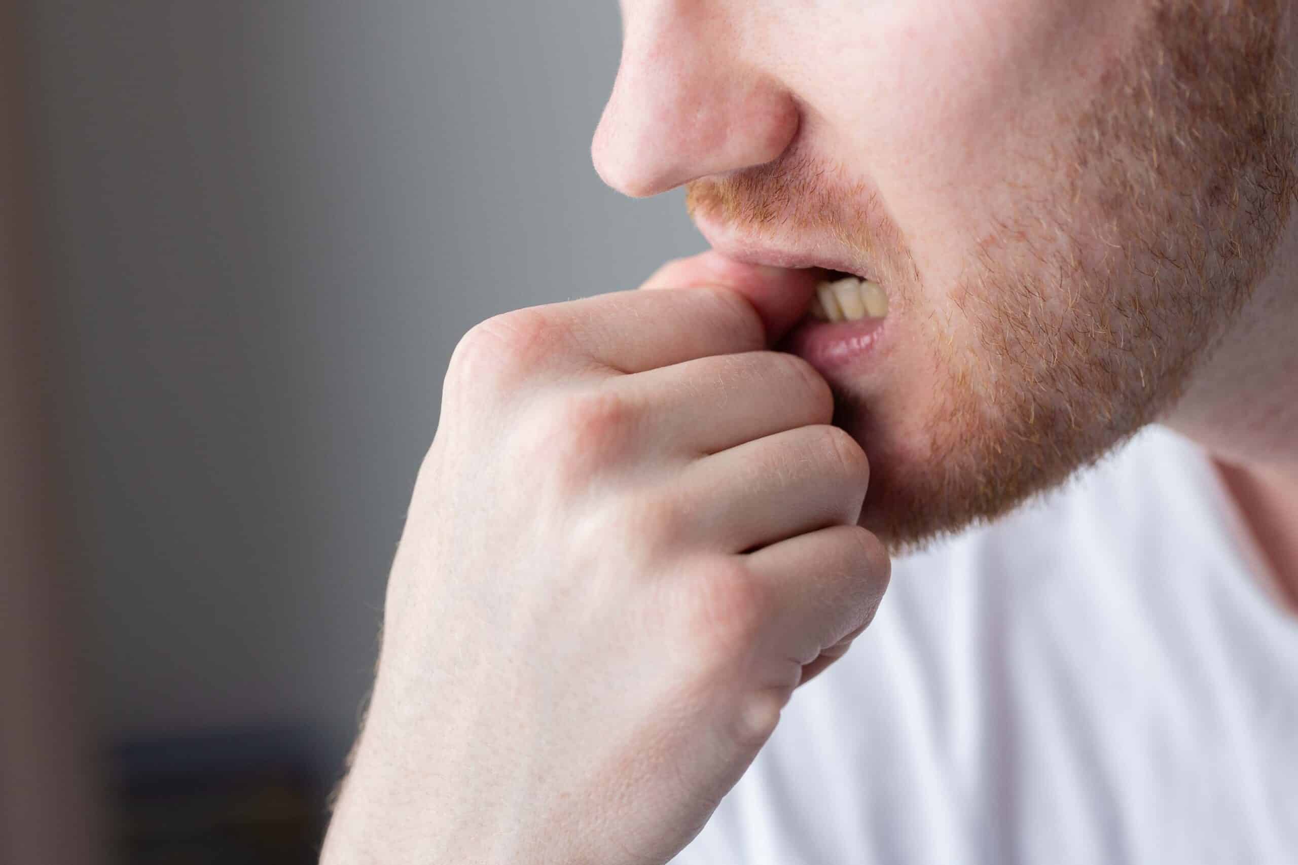 Man biting his fingernails, illustrating habits that can harm dental health, related to oral hygiene tips from Smith Dentalworks.