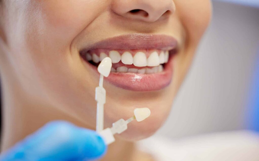 Smiling woman holding teeth shade guide for cosmetic dentistry teeth whitening assessment.