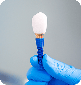 Dental Implants