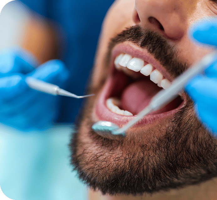 Patient receiving dental care, showcasing advanced technology and personalized treatment at Smith Dentalworks, with dental tools in use for oral examination and care.