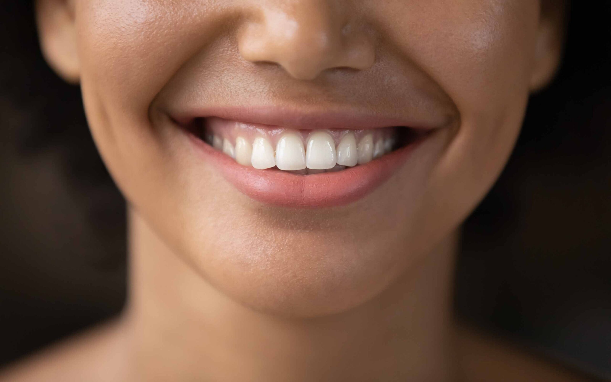 Black Triangle Between Teeth: Causes & Treatment